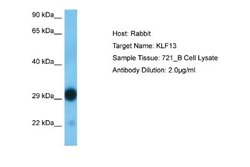 KLF13 Rabbit anti-Human, Polyclonal, Novus Biologicals 0.1ml; Unconjugated:Antibodies,